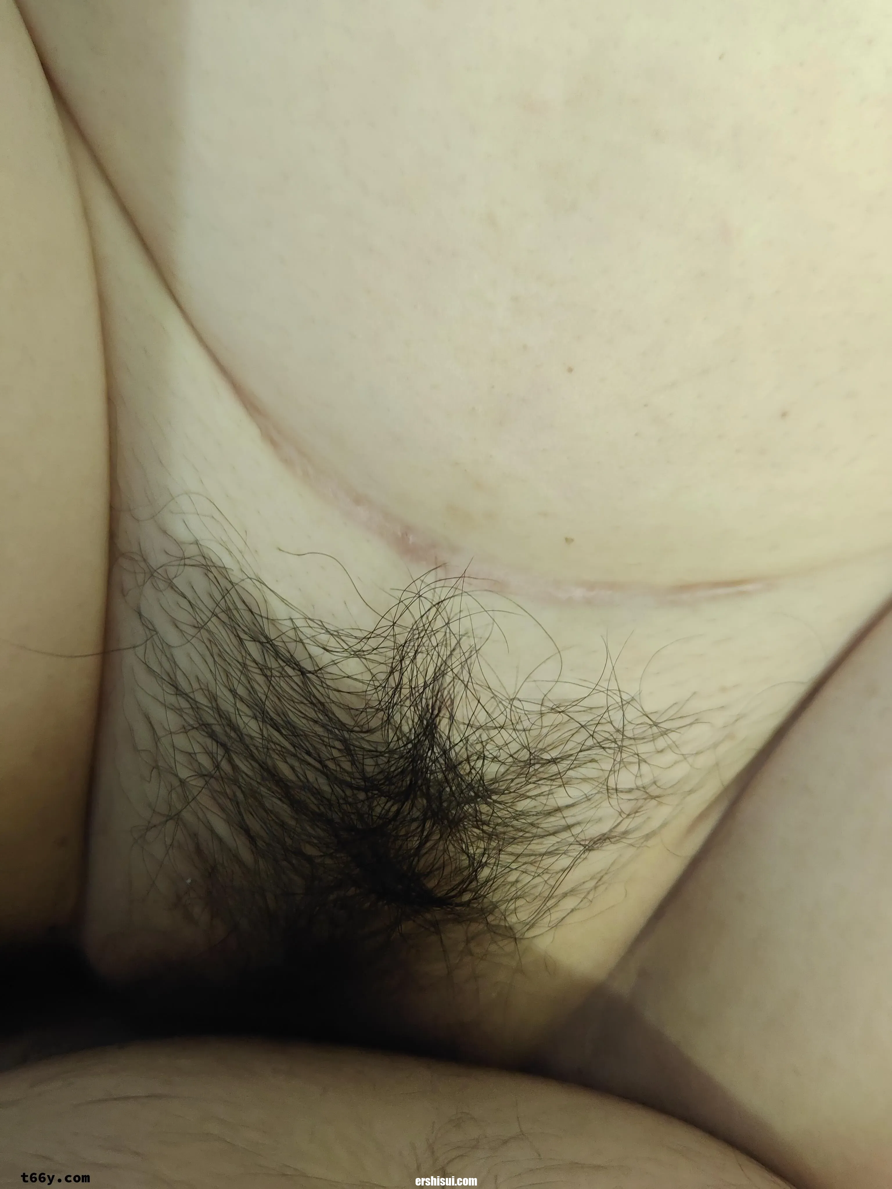 1 (15)
